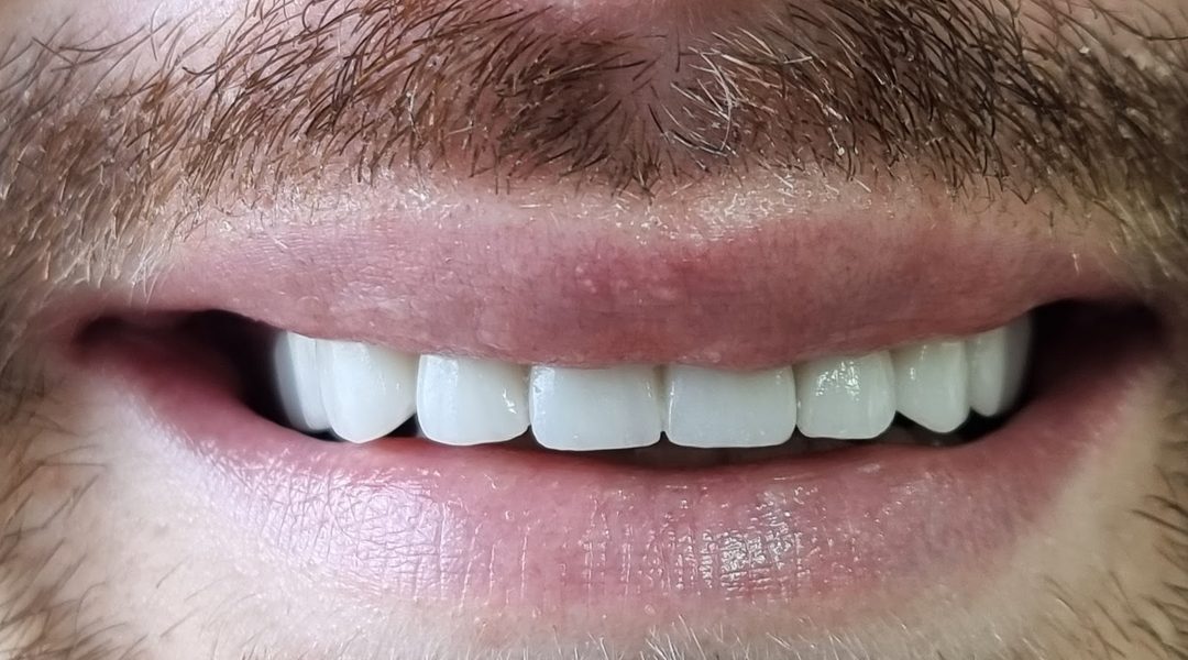 Boba Dent